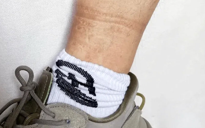Socks Cutting Off Circulation: Causes, Risks, and How to Prevent It