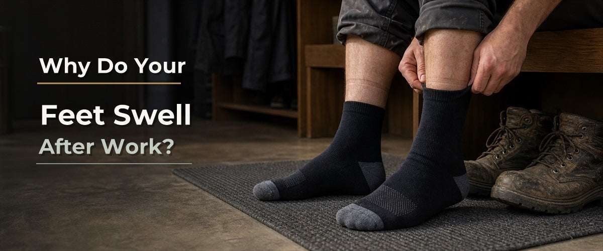 Why Do Your Feet Swell After Work